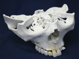 3D顎模型の製作 図